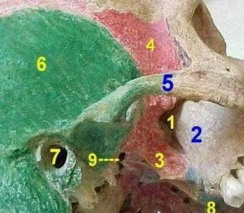 Pterygopalatine fossa: a roadmap for disease spread